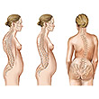 Patologìas de espalda